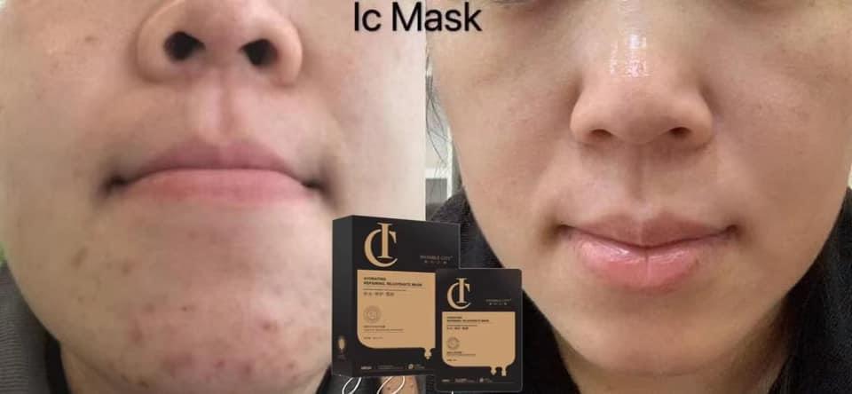 IC Mask: Hydrating, Repairing, Rejuvenate Mask (Black Box)